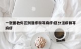 一张图教你区别湿疹和荨麻疹:区分湿疹和荨麻疹